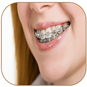 Top 39 Photography Apps Like Braces Photo Editor - Braces For Your Teeth - Best Alternatives