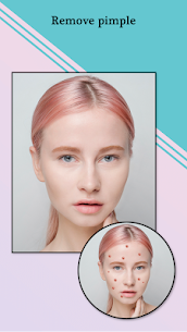 Pimple Remover, Eraser – Face Beauty Maker 3