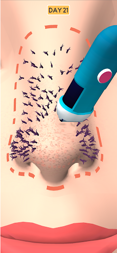Nose Clean - Screenshot 1