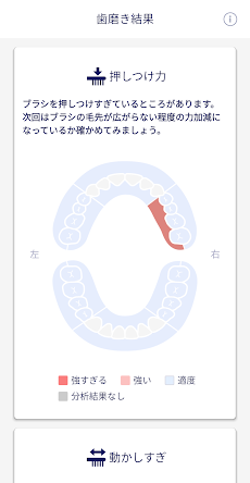 ドルツアプリ：正しい歯周ケアを身に付けましょう。のおすすめ画像3