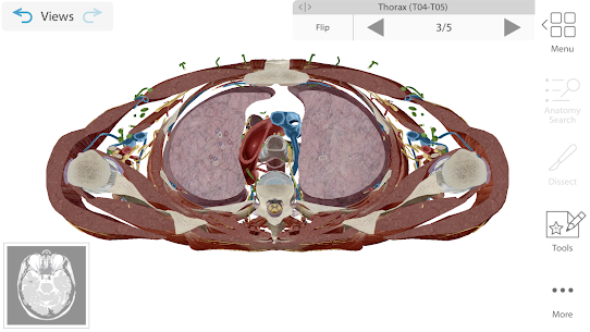 Human Anatomy Atlas 2021  Complete 3D Human Body Apk Download LATEST VERSION 2021 5