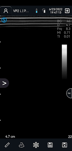 VP2 Screen 2