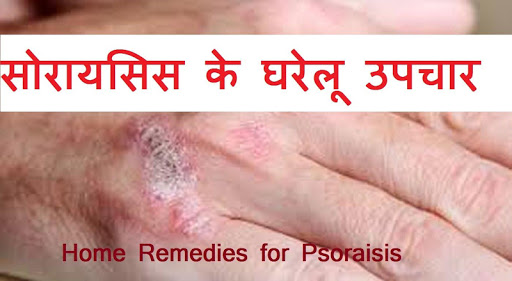 खुजली के इलाज Khujli Ke Ilaj K Screenshot 2 - AppWisp.com