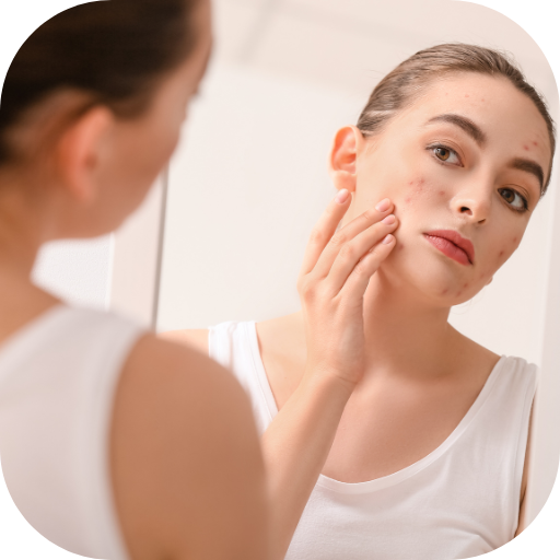 natural acne treatment Download on Windows