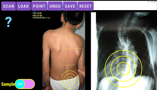 Potsi App Screen 3