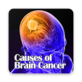 Causes of Brain Cancer icon