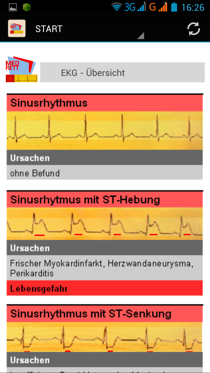 Android application EKG-Monitoring screenshort