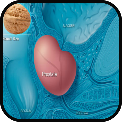 Prostate Cancer Symptoms