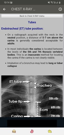 X-RAY Interpretation - cases Screenshot