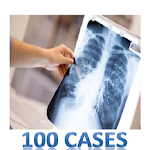 100 Cases In Radiology Apk