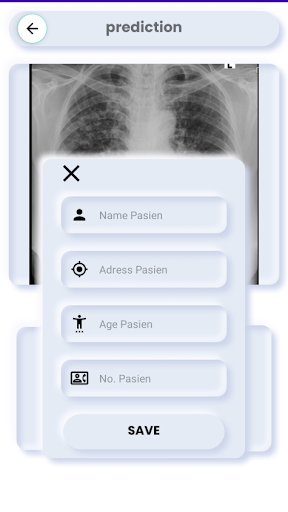 Pneumonia Detection Aid Screen 3