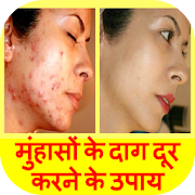 Top 43 Health & Fitness Apps Like Pimple Marks Removal in Hindi - Best Alternatives
