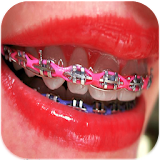 Braces teeth booth Camera icon