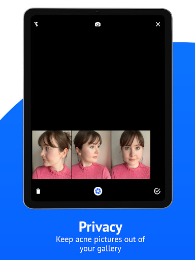 SkinTheory Skin + Acne Tracker screenshot