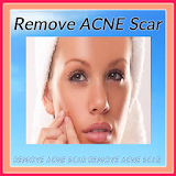 Remove Acne Scar icon