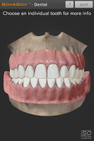 screenshot of BoneBox™ - Dental Lite