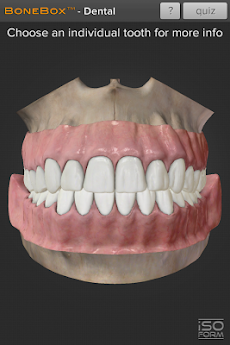 BoneBox™ - Dental Liteのおすすめ画像1
