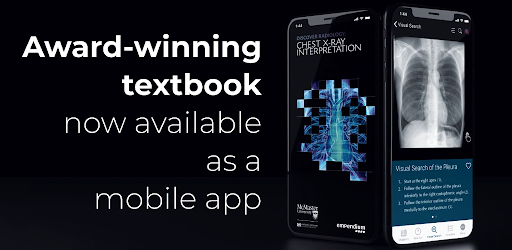 Discover Radiology Chest X Ray Interpretation Apps On Google Play