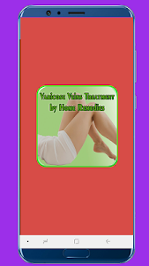 Varicose Veins Treatment by Ho Unknown