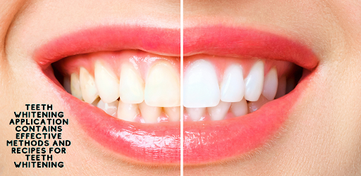teeth whitening screenshot