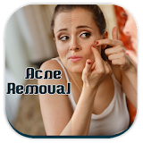 Acne Removal Tips icon