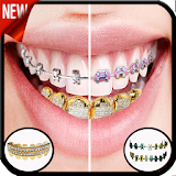 Gold Teeth & Braces photo editor icon