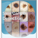Cover Image of Скачать Skin Cancer Detection 1.1 APK