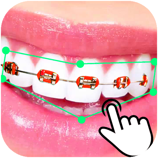 Braces Booth Stickers photo ed logo
