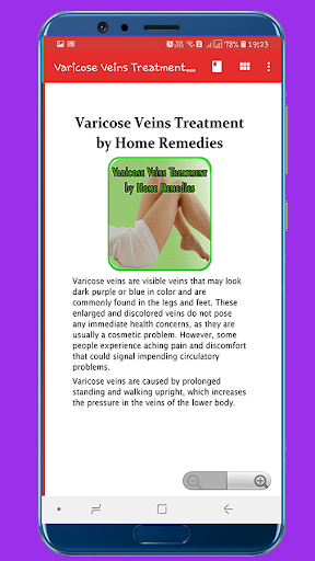 Varicose Veins Treatment by Ho Screen 2