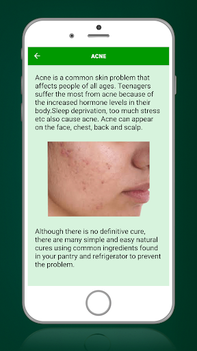 Aloe Vera Benefits! Screenshot 4 - AppWisp.com