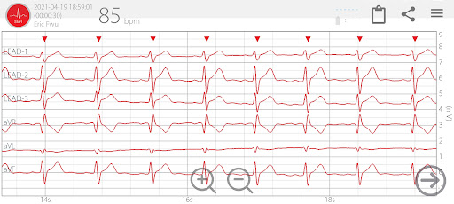 inCare Screen 2