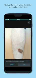 Skin Check: Hautarzt App