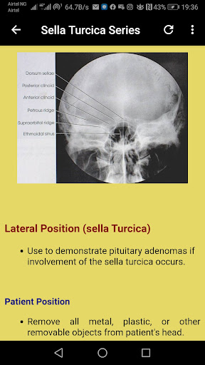 Skull Radiographic Anatomy Screen 3