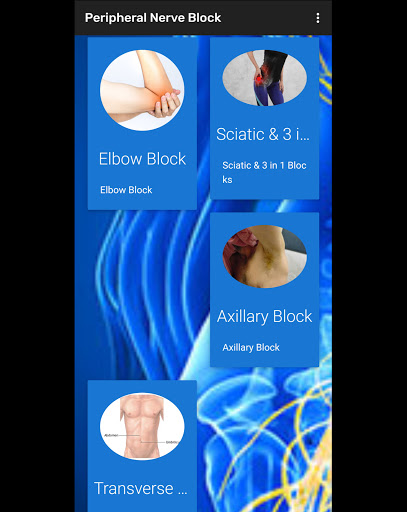 Peripheral Nerve Block