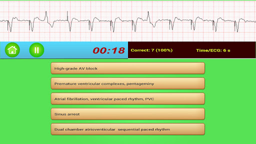 ECG Rhythm