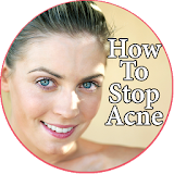 How To Stop Acne icon