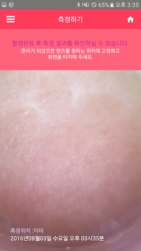 힐스킨 체커 Healskin Checker Screen 2