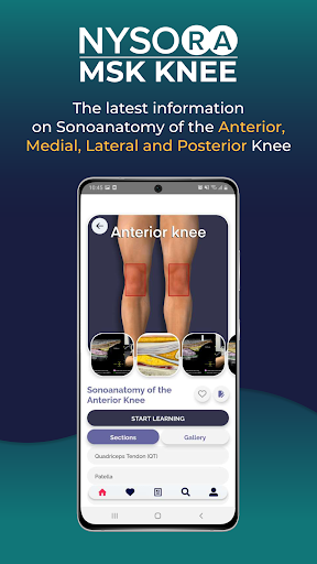 NYSORA MSK US Knee App Screen 3