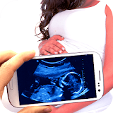 Baby Ultrasound Scanner :Prank icon