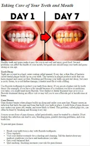 あなたの歯の世話をする方法