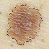 Skin Cancer Image Viewer icon