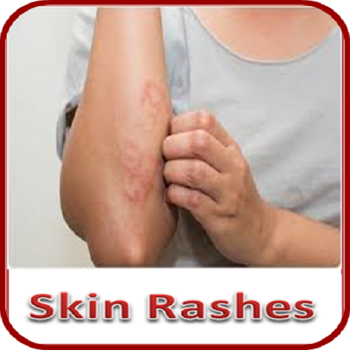 Skin Rashes 5.1 Icon