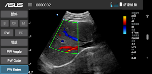 screenshot of MediConnect – ASUS Ultrasound