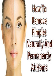 Pimples Removing Tips 1
