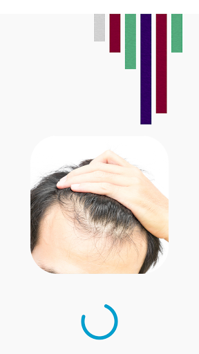 علاج تساقط الشعر