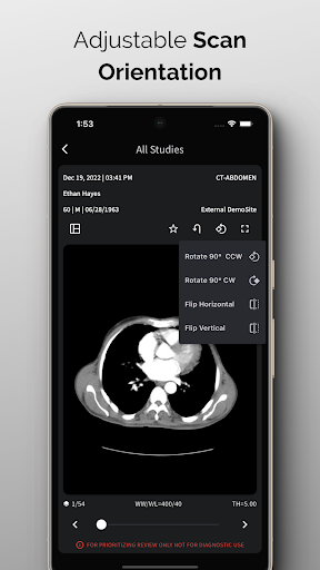 NeuroView Screenshot 3 - AppWisp.com