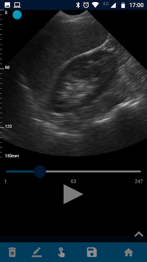 VistaScan Ultrasound App Screen 2