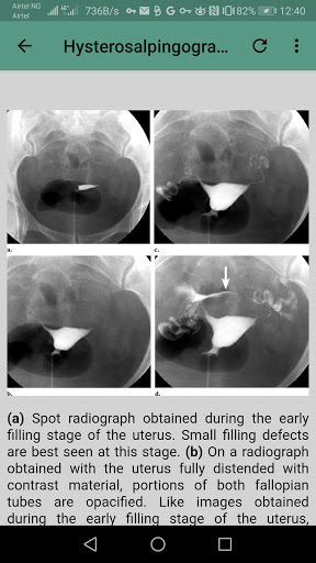 Urogenital Tract X ray