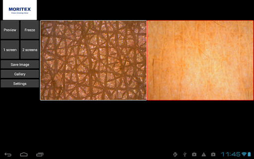 i-Scope ® viewer for Android Screen 2