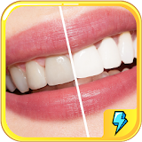 Teeth Whitening Secret Tips icon